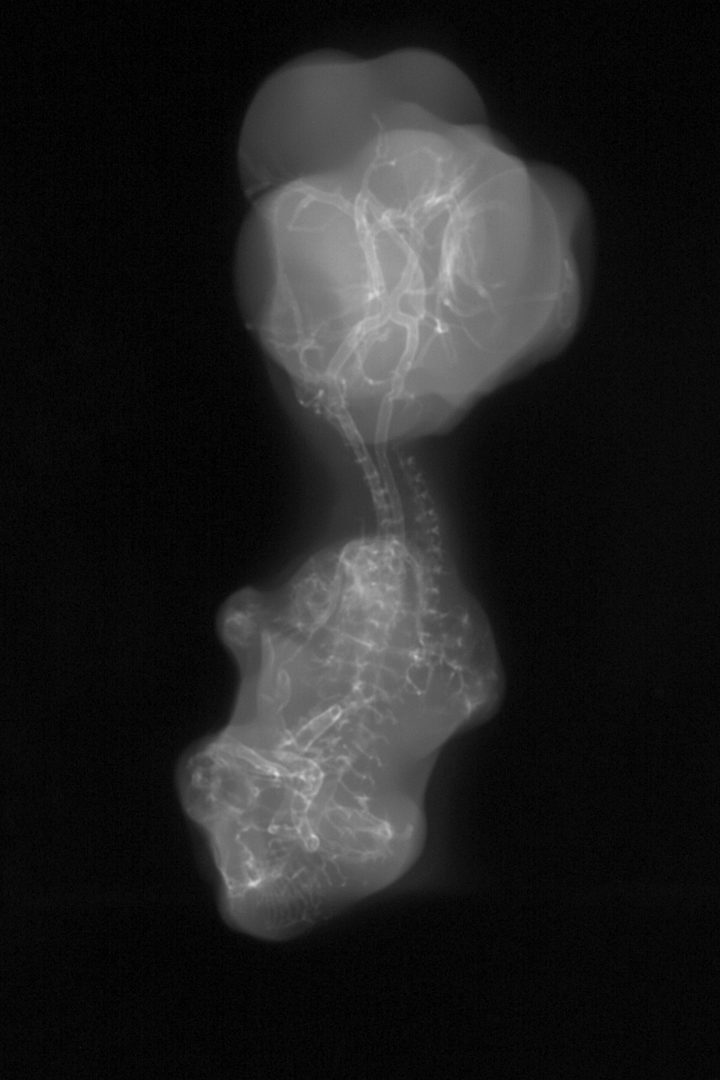 stage 29 chick embryo x-ray